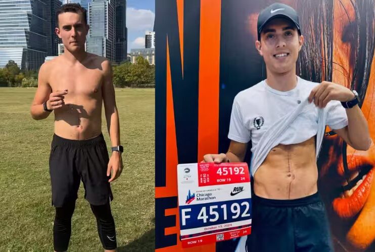 Conheça Thiago, o brasileiro que venceu câncer e correu a Maratona de Chicago