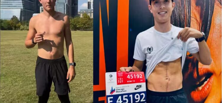 Conheça Thiago, o brasileiro que venceu câncer e correu a Maratona de Chicago