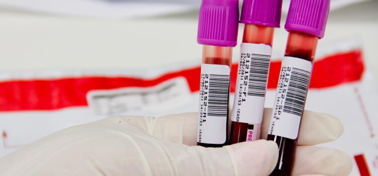 Novo exame de sangue ajuda a detectar Alzheimer e demência